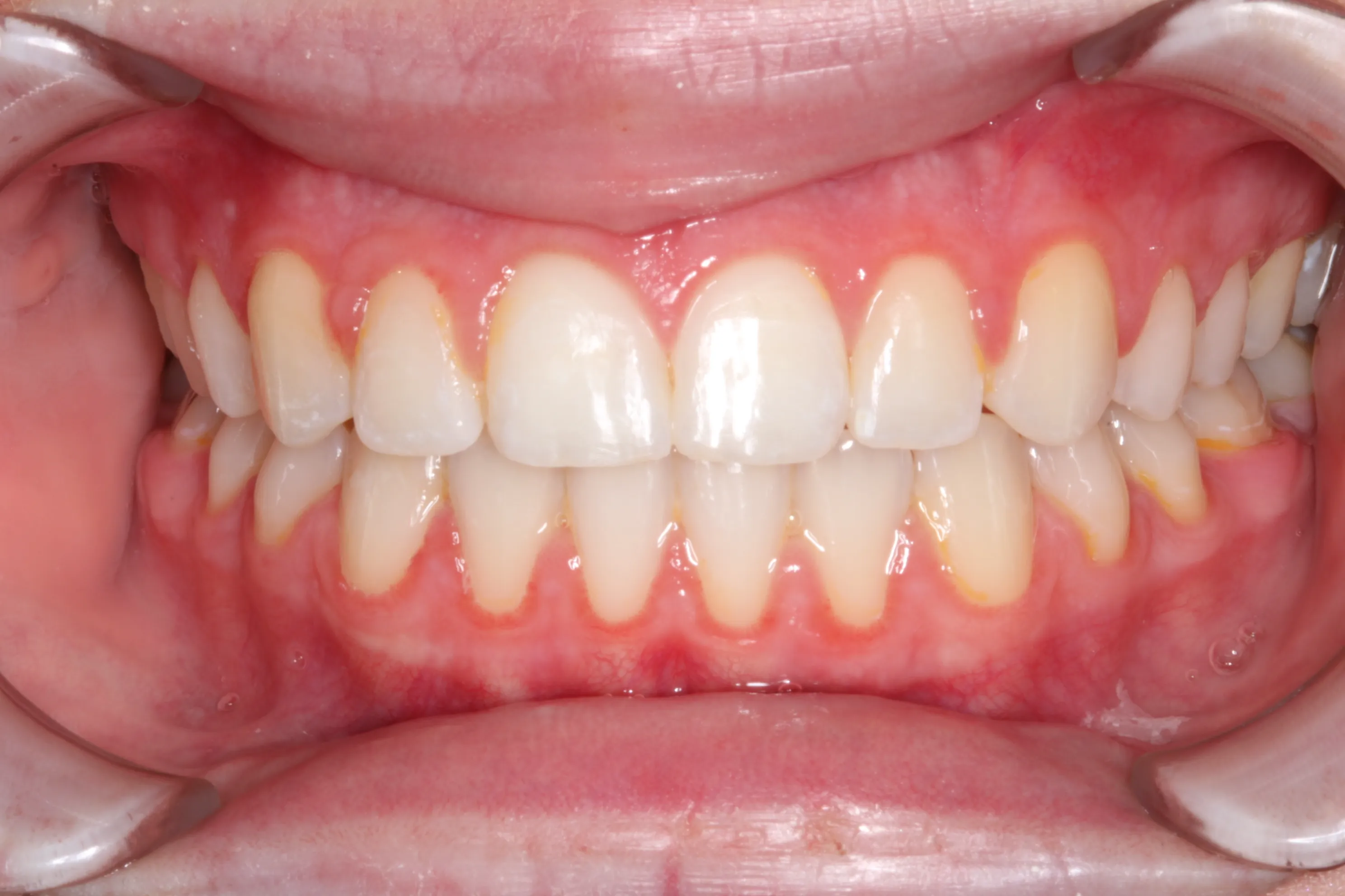 smile-gallery gallery